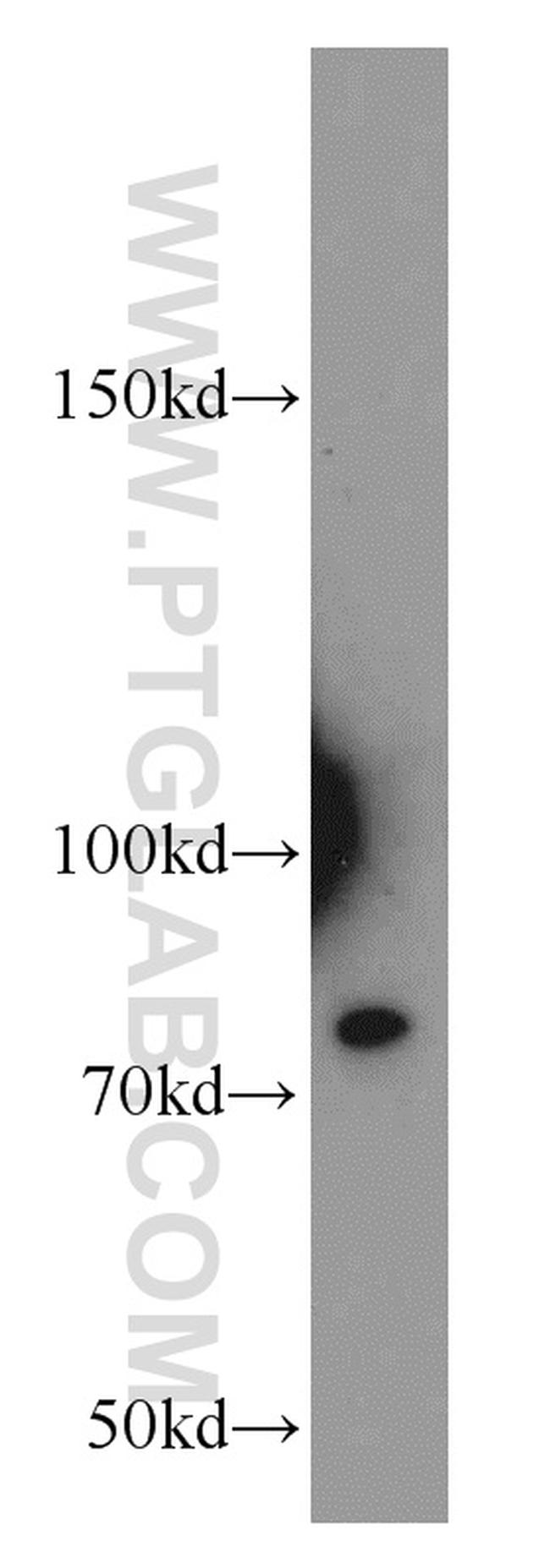 PCSK9 Antibody in Western Blot (WB)