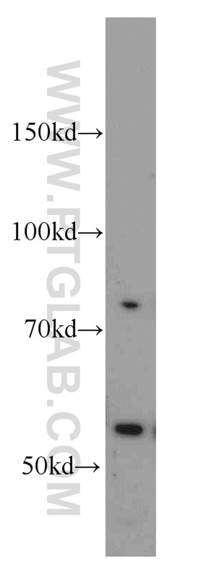 PCSK9 Antibody in Western Blot (WB)