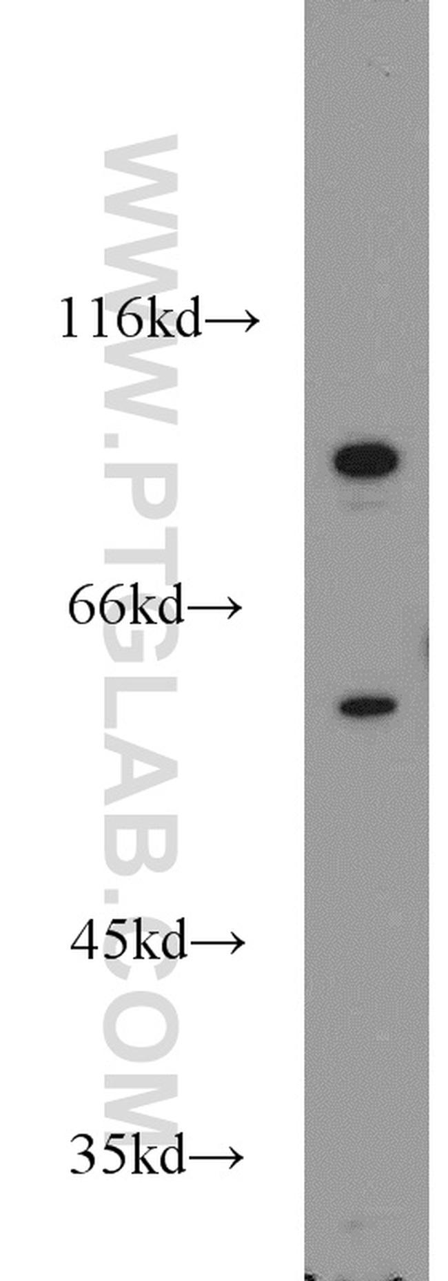 PCSK9 Antibody in Western Blot (WB)