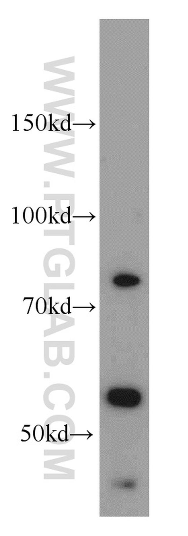 PCSK9 Antibody in Western Blot (WB)