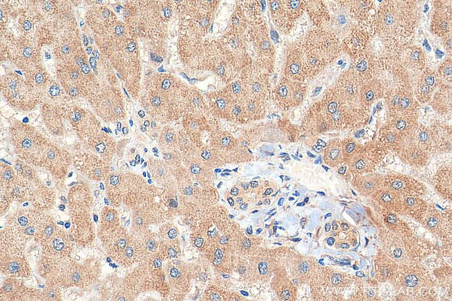 ACADM Antibody in Immunohistochemistry (Paraffin) (IHC (P))