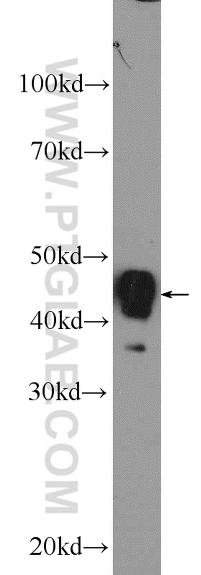 ACADM Antibody in Western Blot (WB)