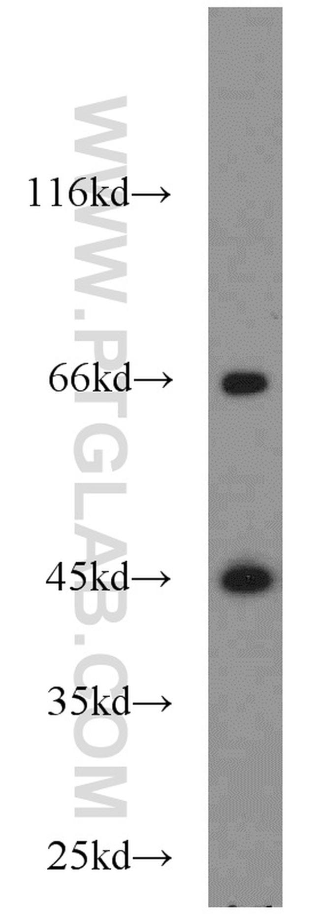 ACADM Antibody in Western Blot (WB)