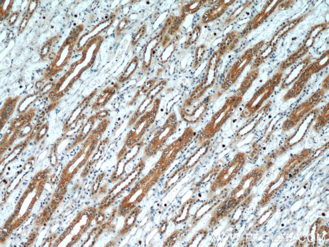 PLS1 Antibody in Immunohistochemistry (Paraffin) (IHC (P))