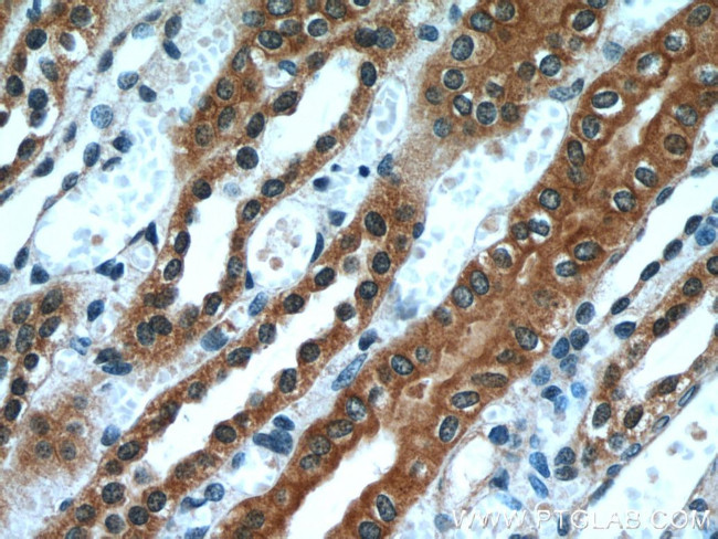 PLS1 Antibody in Immunohistochemistry (Paraffin) (IHC (P))