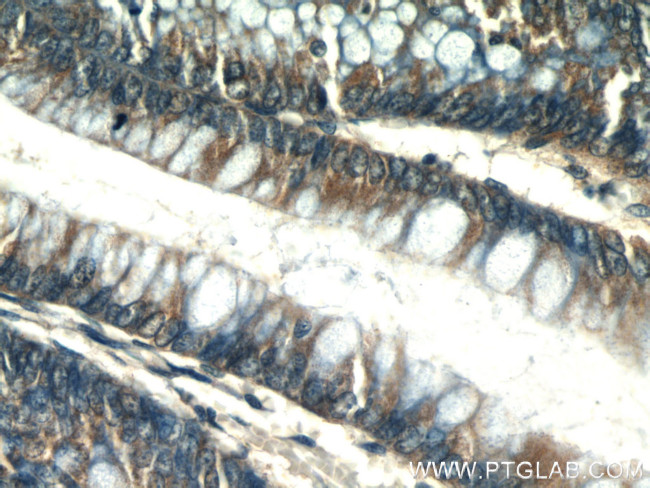 PLS1 Antibody in Immunohistochemistry (Paraffin) (IHC (P))