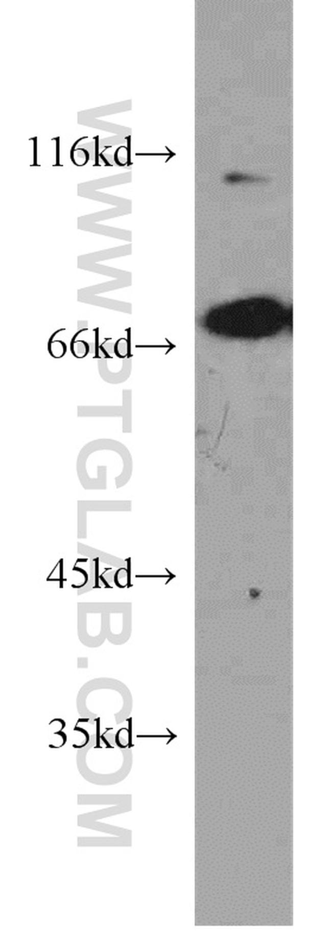 PLS1 Antibody in Western Blot (WB)