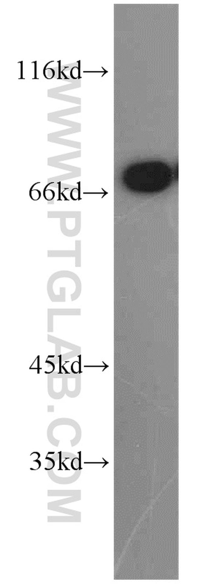 PLS1 Antibody in Western Blot (WB)