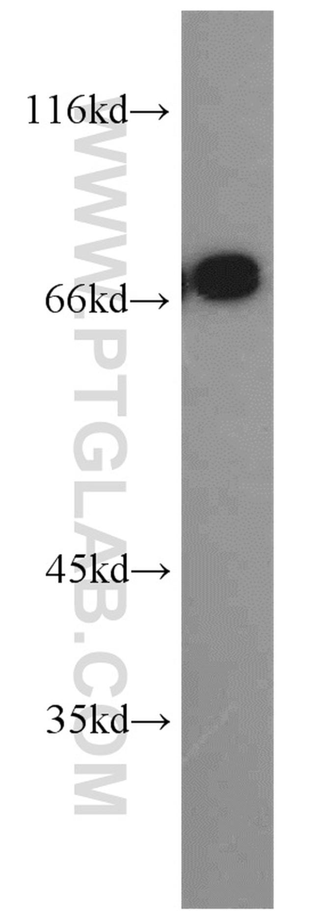 PLS1 Antibody in Western Blot (WB)