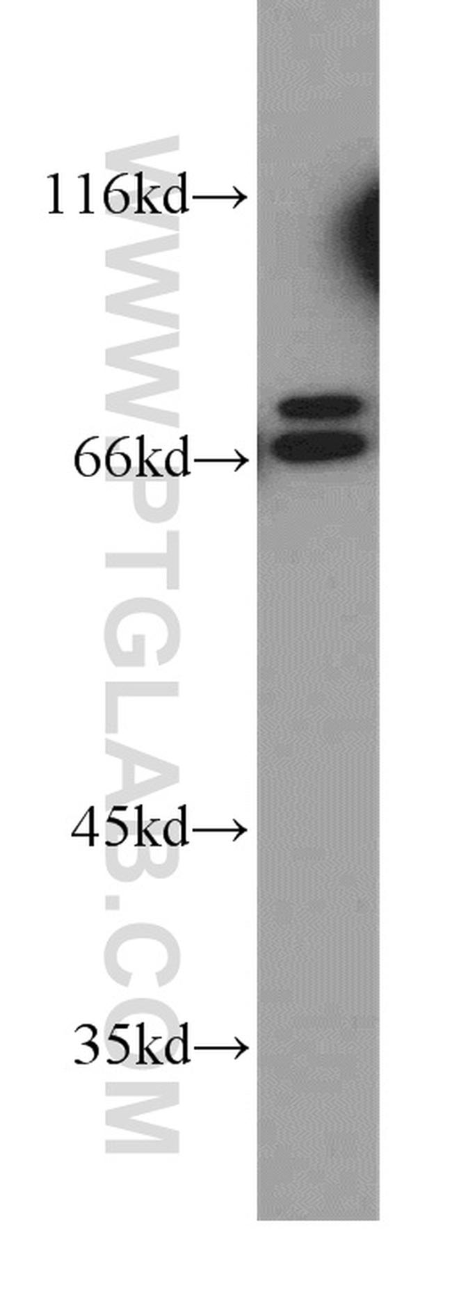 PLS1 Antibody in Western Blot (WB)