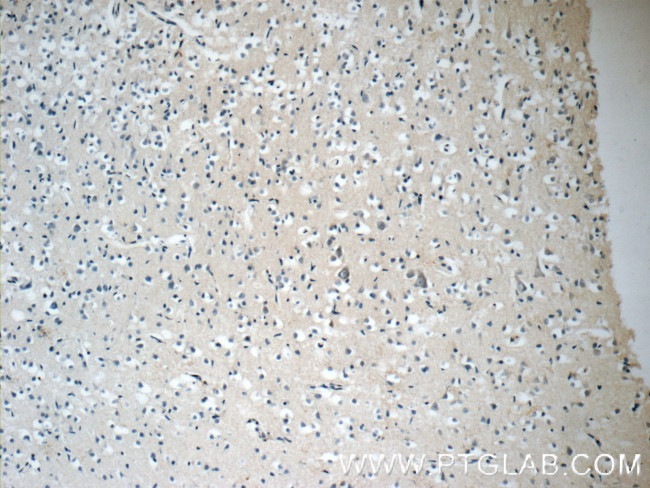 ARHGEF4 Antibody in Immunohistochemistry (Paraffin) (IHC (P))