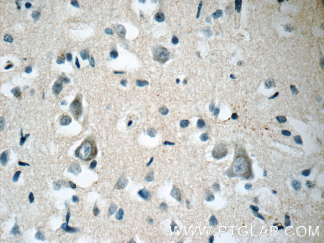 ARHGEF4 Antibody in Immunohistochemistry (Paraffin) (IHC (P))