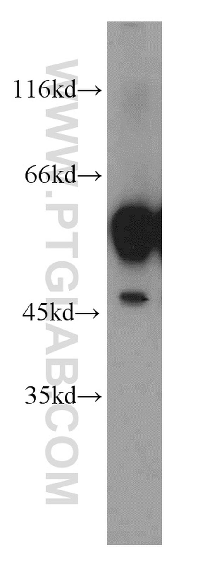 GDI1 Antibody in Western Blot (WB)