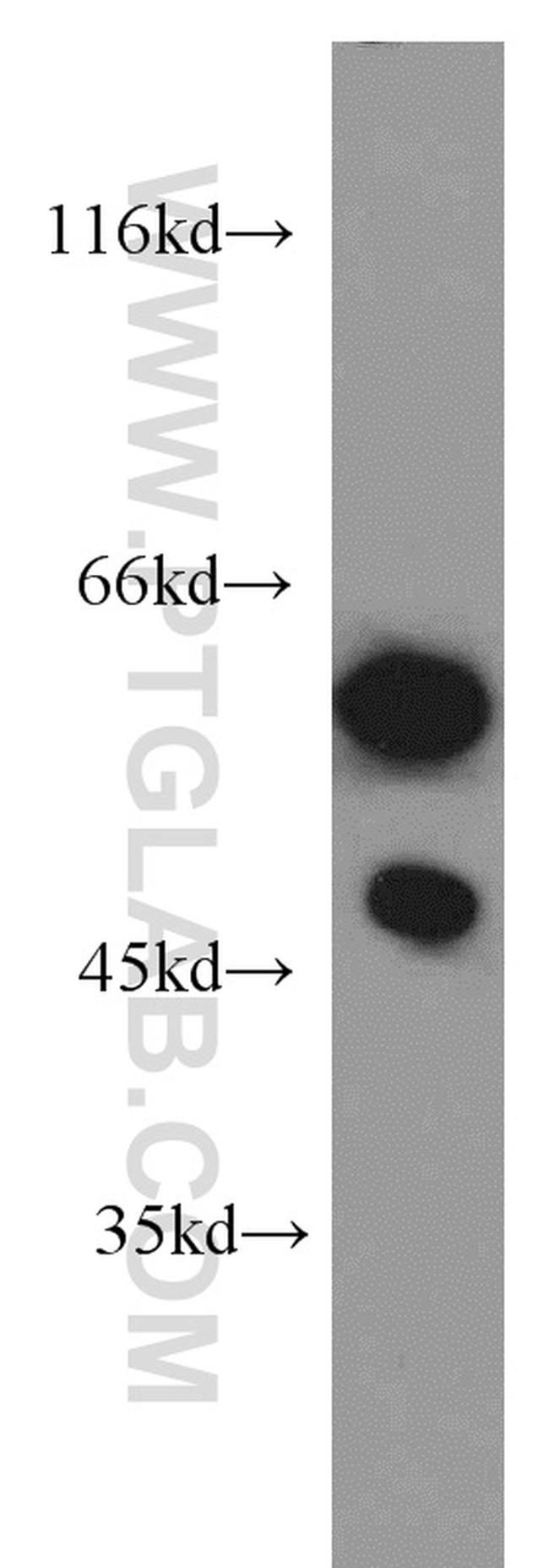 GDI1 Antibody in Western Blot (WB)