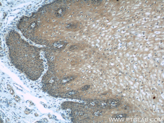 PLS3 Antibody in Immunohistochemistry (Paraffin) (IHC (P))