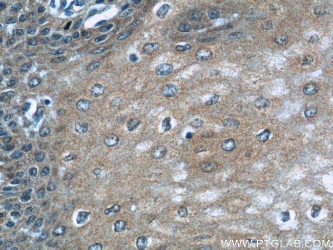 PLS3 Antibody in Immunohistochemistry (Paraffin) (IHC (P))