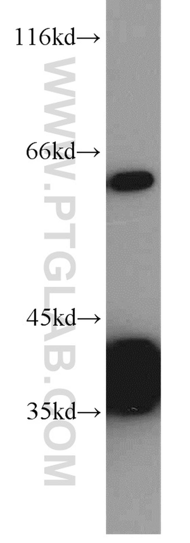 PLS3 Antibody in Western Blot (WB)