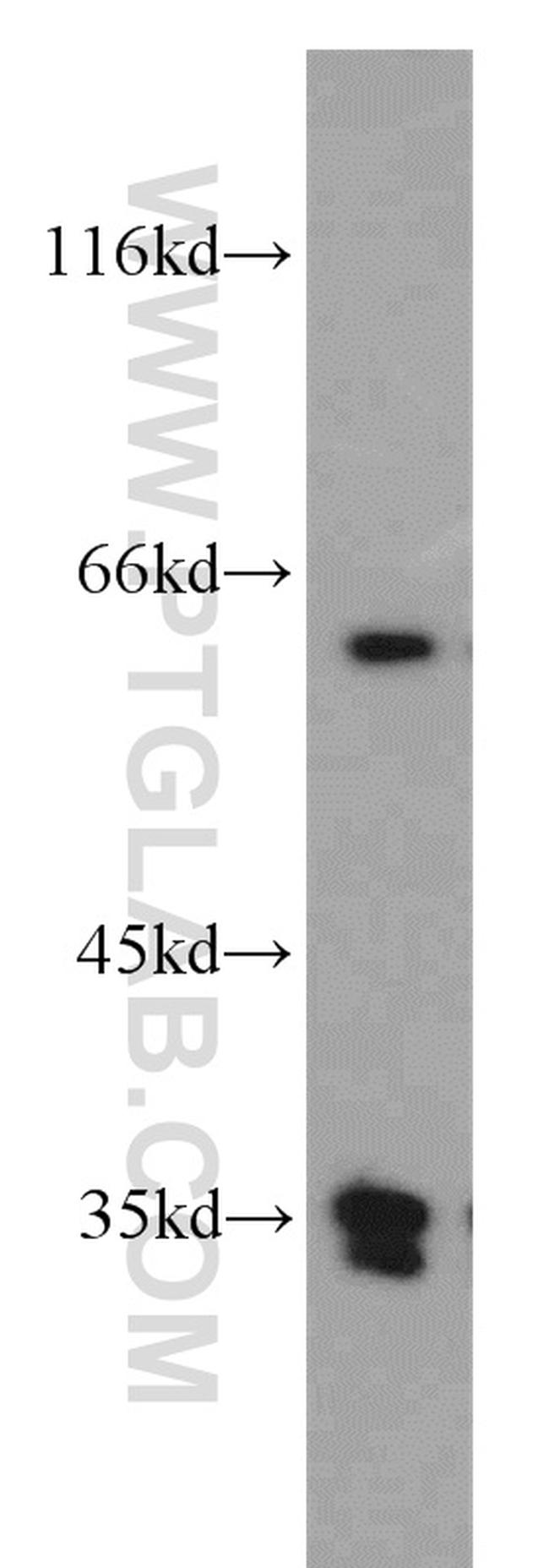 PLS3 Antibody in Western Blot (WB)