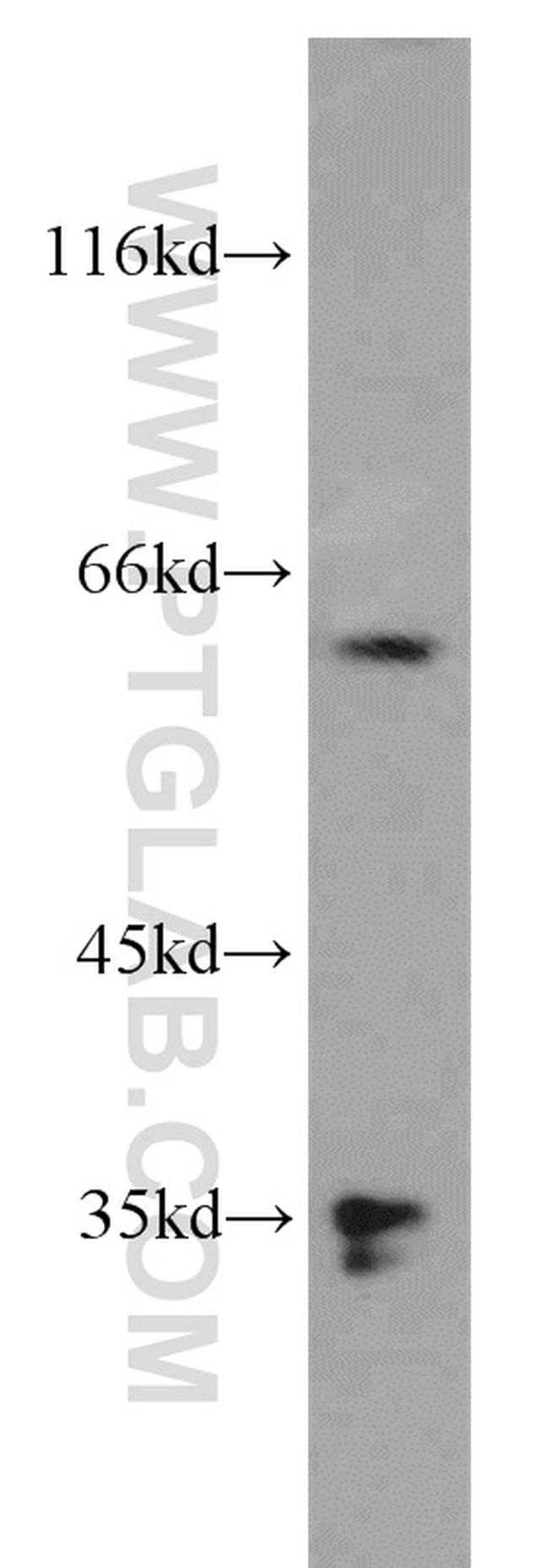 PLS3 Antibody in Western Blot (WB)