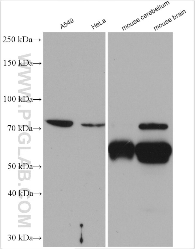 CaMKII beta Antibody in Western Blot (WB)