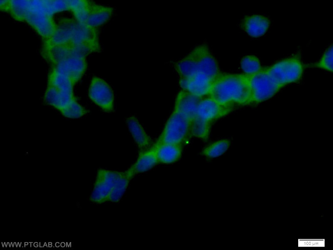 CaMKII beta Antibody in Immunocytochemistry (ICC/IF)