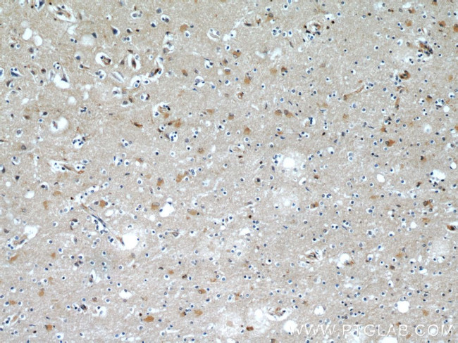 CaMKII beta Antibody in Immunohistochemistry (Paraffin) (IHC (P))