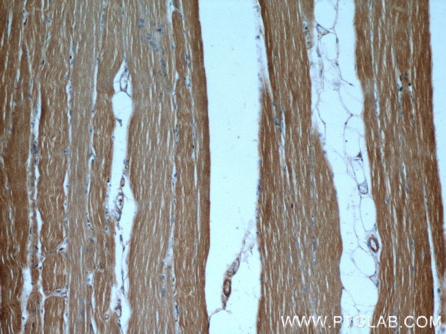 CaMKII beta Antibody in Immunohistochemistry (Paraffin) (IHC (P))