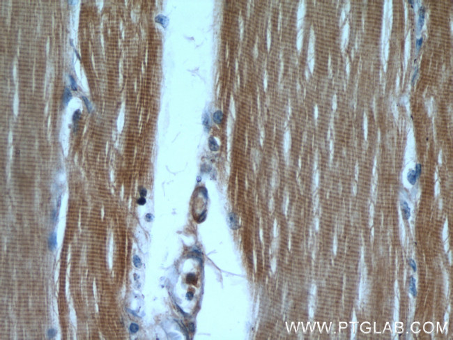 CaMKII beta Antibody in Immunohistochemistry (Paraffin) (IHC (P))