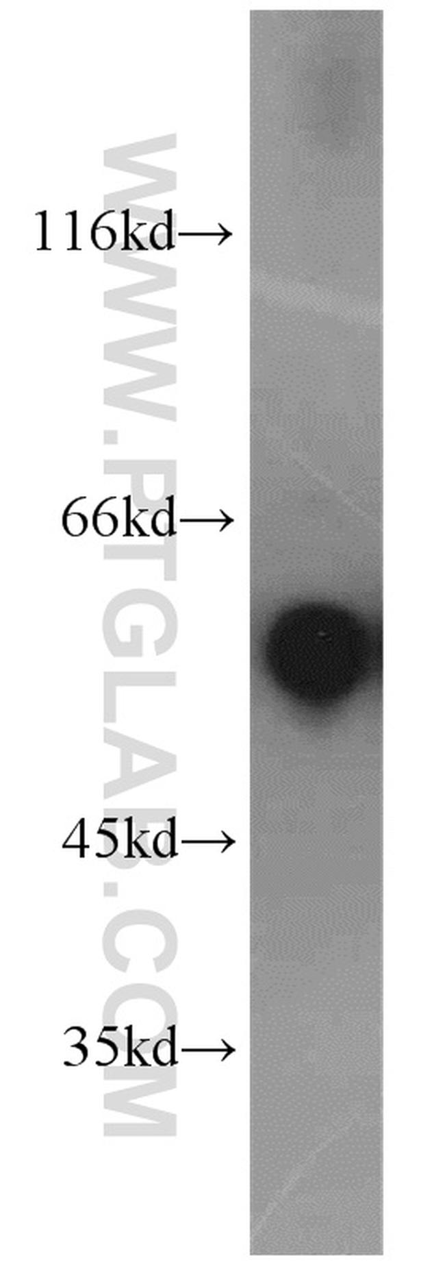 CaMKII beta Antibody in Western Blot (WB)