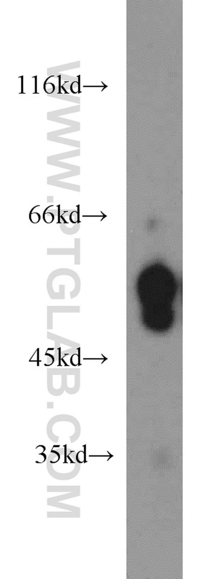 CaMKII beta Antibody in Western Blot (WB)