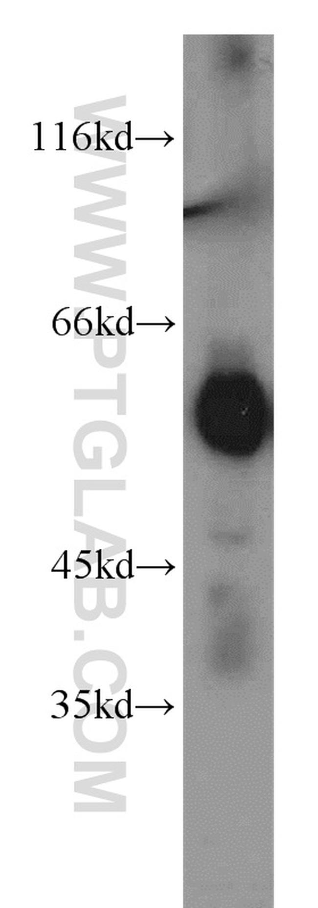 CaMKII beta Antibody in Western Blot (WB)