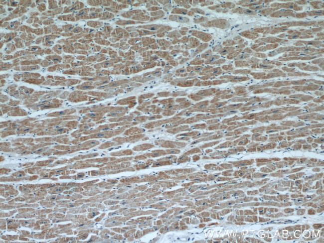 HCN1 Antibody in Immunohistochemistry (Paraffin) (IHC (P))