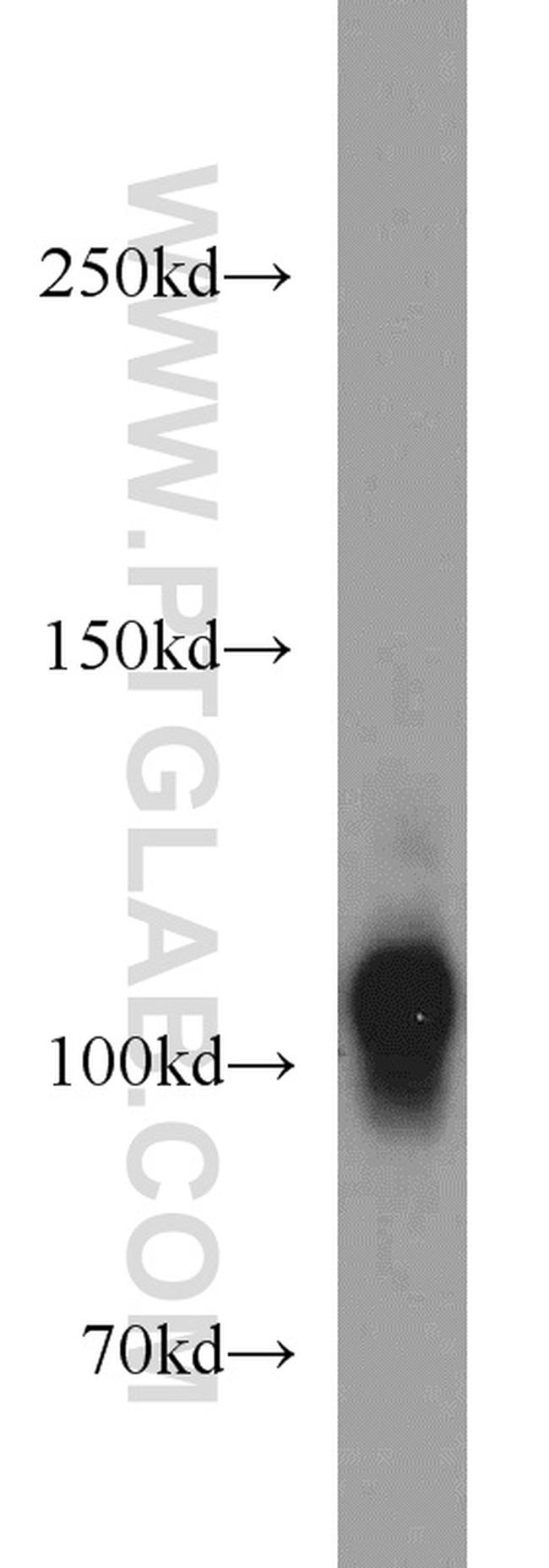 HCN1 Antibody in Western Blot (WB)