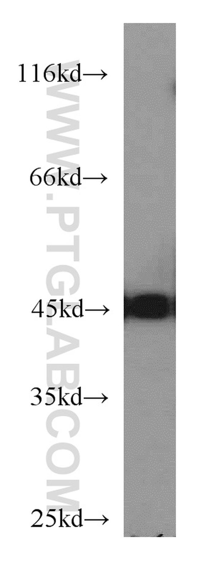 NSE/ENO2 Antibody in Western Blot (WB)