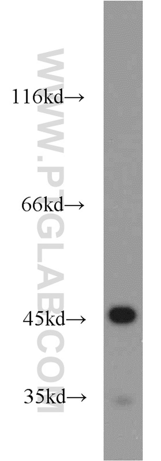 NSE/ENO2 Antibody in Western Blot (WB)