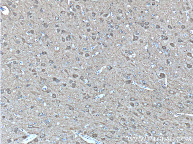 NSE/ENO2 Antibody in Immunohistochemistry (Paraffin) (IHC (P))