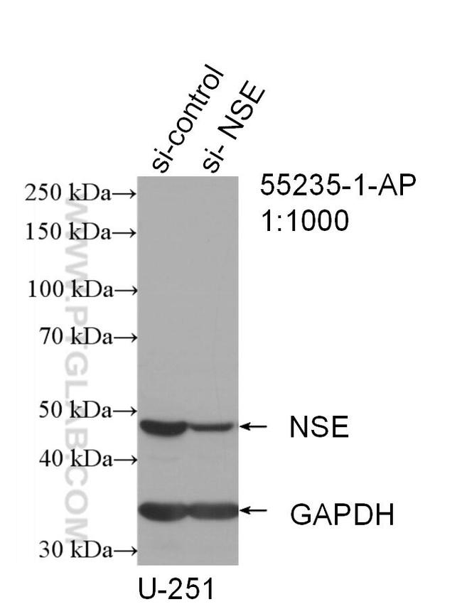 NSE/ENO2 Antibody in Western Blot (WB)