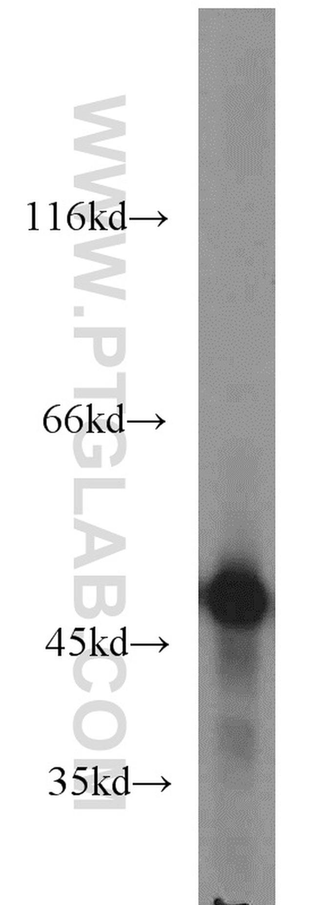 ENO1 Antibody in Western Blot (WB)