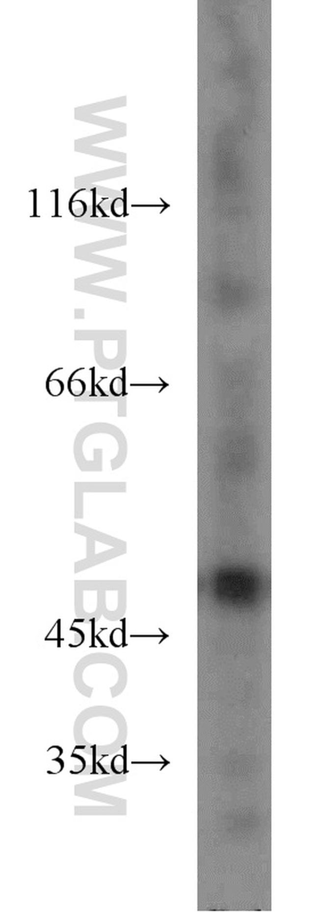 ENO1 Antibody in Western Blot (WB)