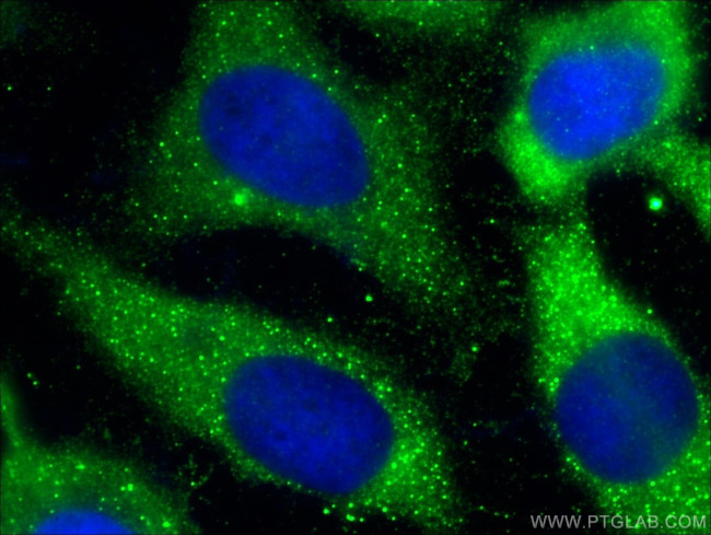 Caspase 12 Antibody in Immunocytochemistry (ICC/IF)