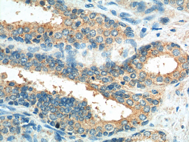 Caspase 12 Antibody in Immunohistochemistry (Paraffin) (IHC (P))