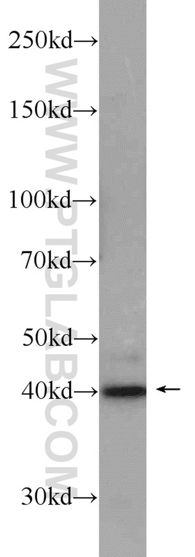 Caspase 12 Antibody in Western Blot (WB)