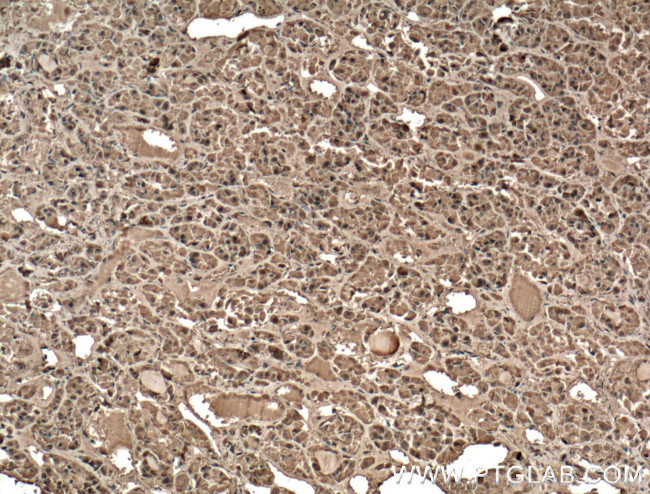 Growth hormone Antibody in Immunohistochemistry (Paraffin) (IHC (P))