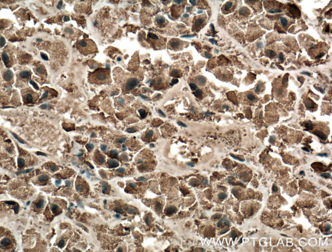 Growth hormone Antibody in Immunohistochemistry (Paraffin) (IHC (P))