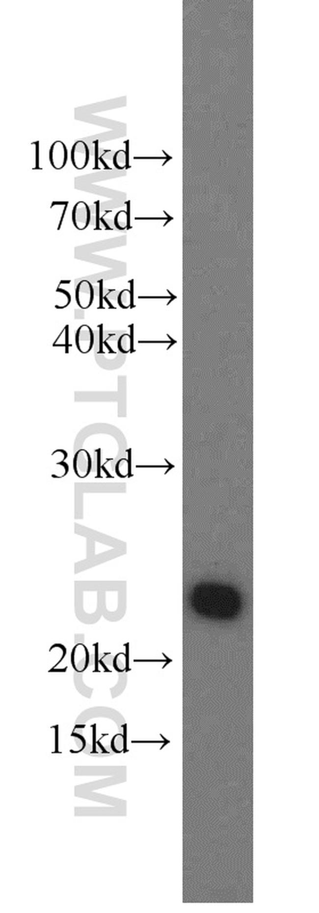 Growth hormone Antibody in Western Blot (WB)