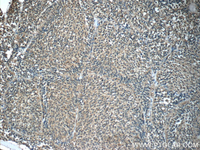 Growth hormone Antibody in Immunohistochemistry (Paraffin) (IHC (P))