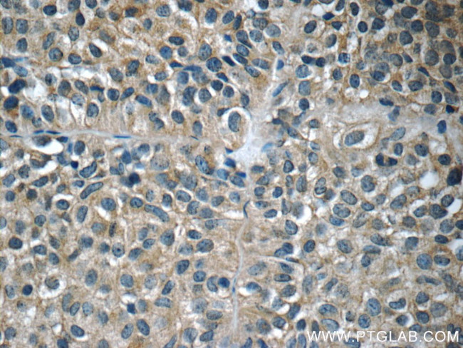 Growth hormone Antibody in Immunohistochemistry (Paraffin) (IHC (P))