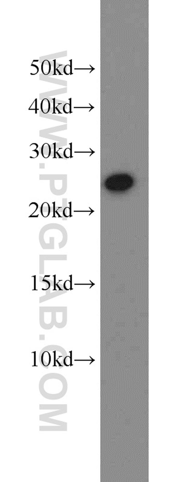 Growth hormone Antibody in Western Blot (WB)