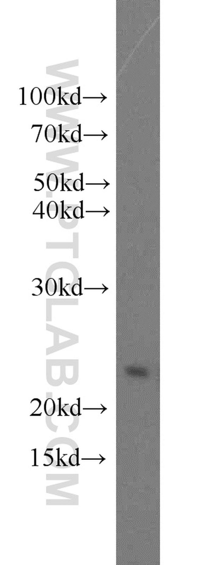 Growth hormone Antibody in Western Blot (WB)