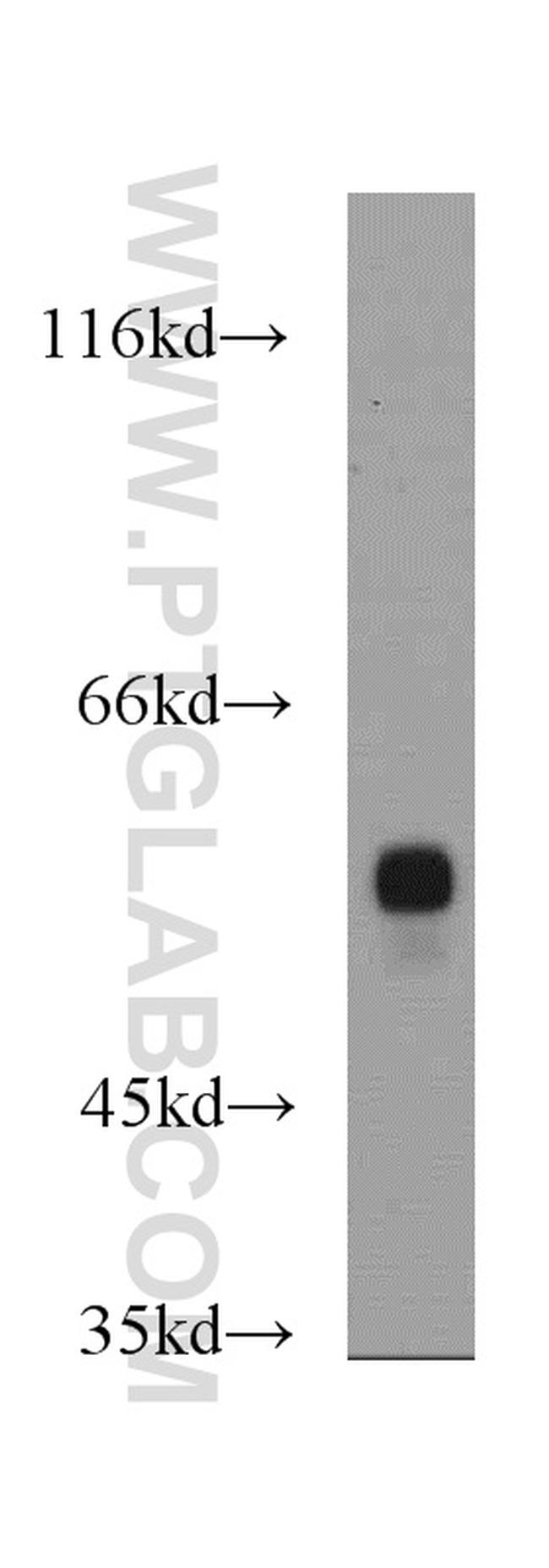 MAP4K2 Antibody in Western Blot (WB)